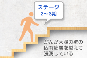ステージ2~3期の治療方針