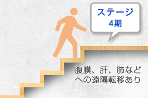 ステージ4期の治療方針