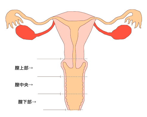 膣がんはどのように診断されますか?
