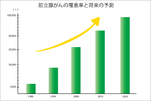 前立腺がんの罹患率と将来の予測