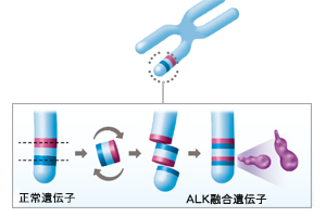 ALK融合遺伝子とは?