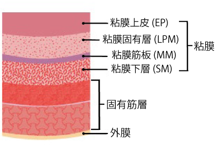 食道がんの粘膜構造