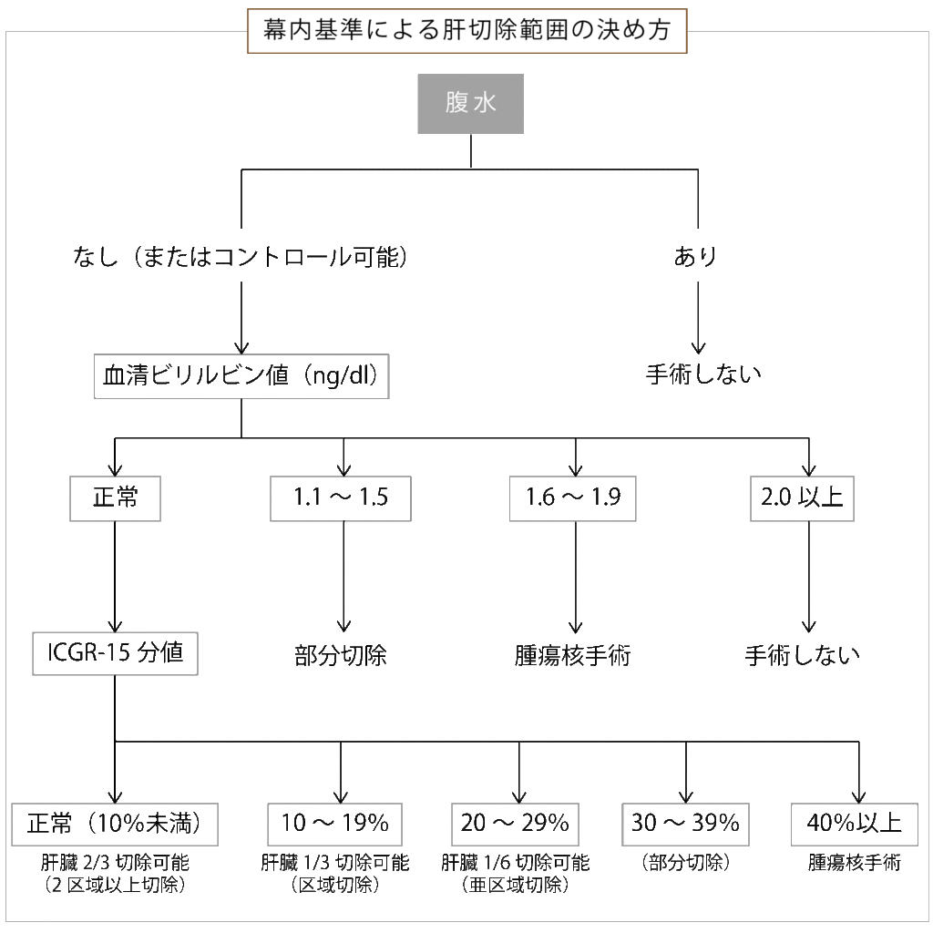 幕内基準による肝切除範囲の決め方